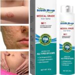 عرض أربع قطع بخاخ للعناية بالبشرة وإزالة حب الشباب والندوب القديمة