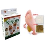 ⁦عرض 2 علبة لاصقة ازالة السموم السحرية * 10 قطع⁩ - الصورة ⁦3⁩