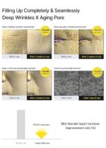 ⁦Retinal shot⁩ - الصورة ⁦3⁩